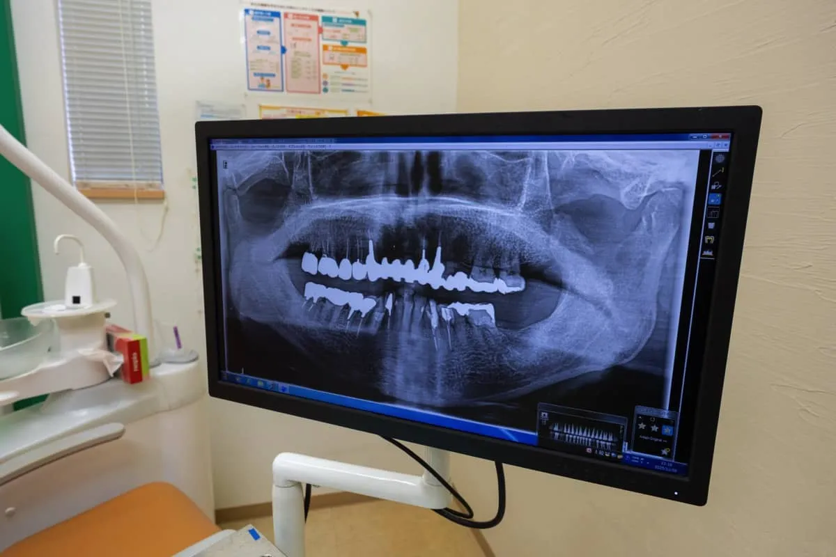 予防歯科の大切さ